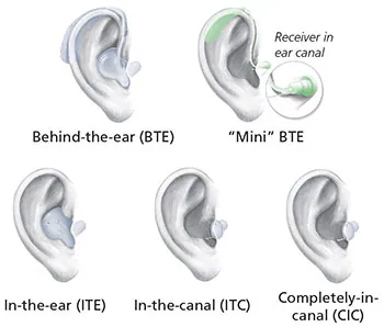 audio power hearing aid batteries